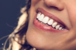 invisalign dentist bountiful ut