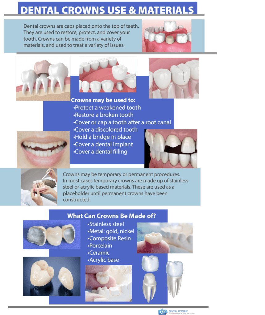 dental crown procedure in bountiful, ut