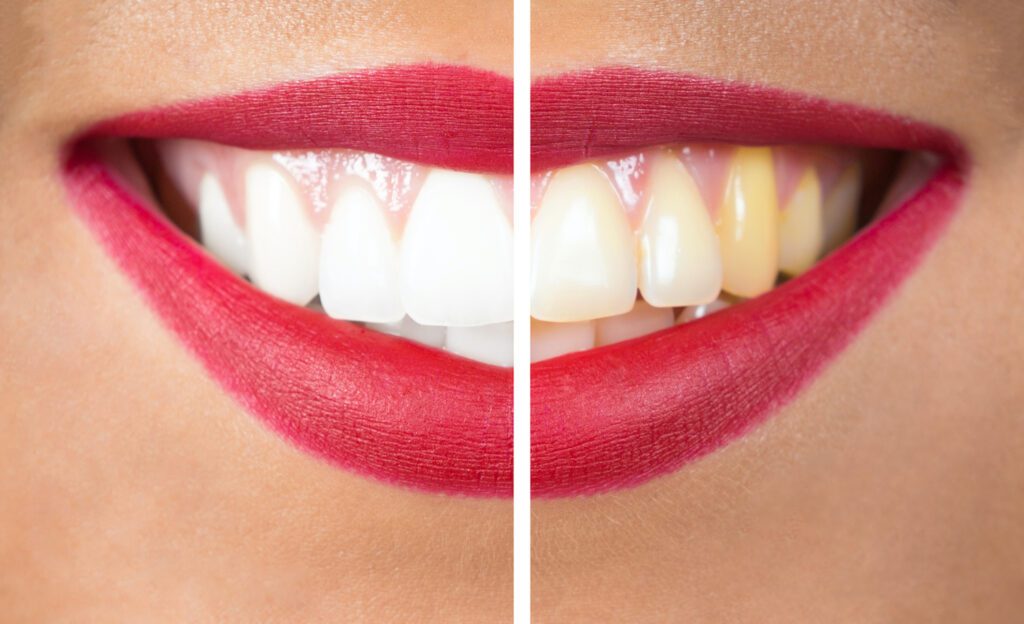 COSMETIC DENTISTRY in BOUNTIFUL UT can help restore your smile and improve your oral health